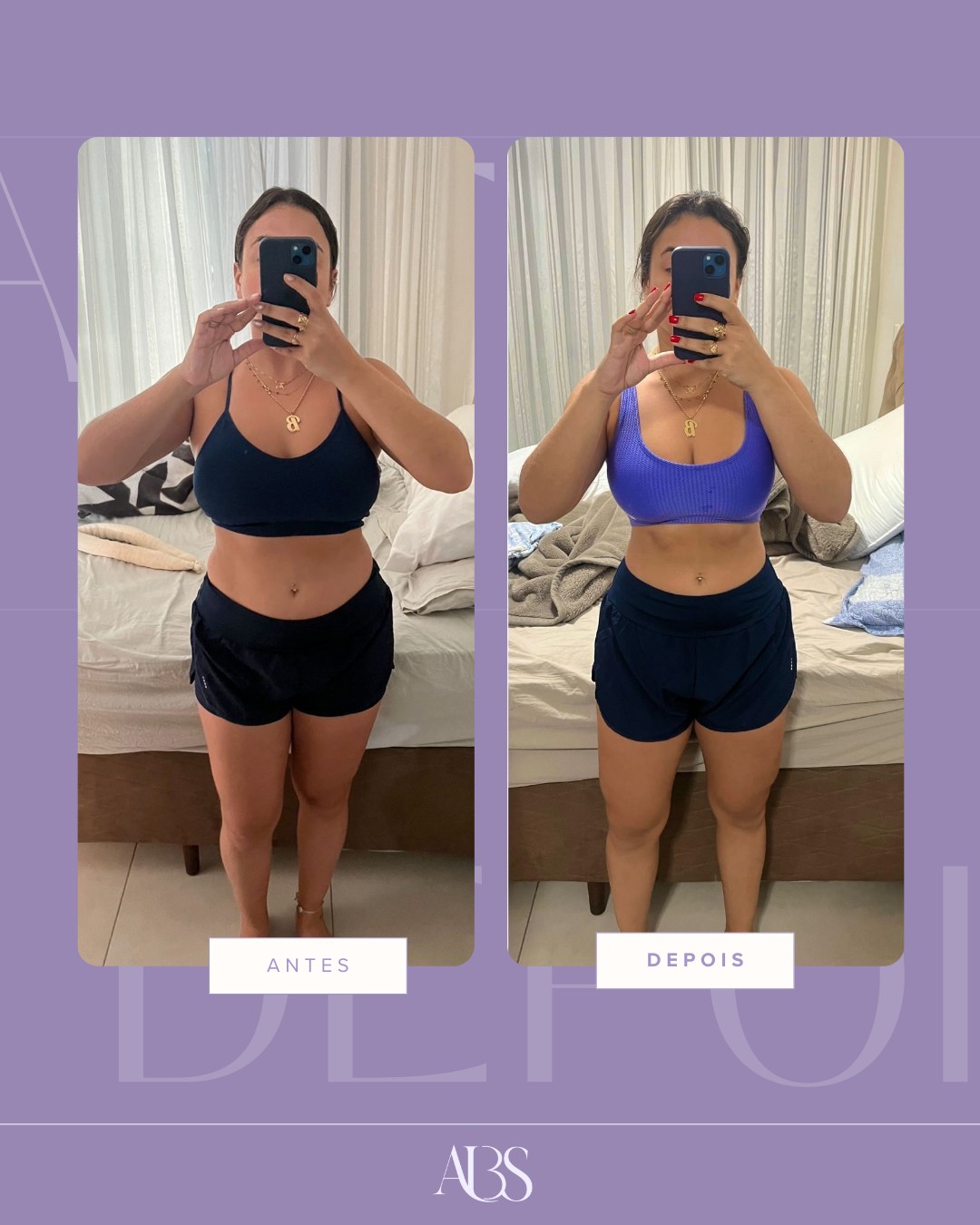 Resultado antes e depois, paciente 5