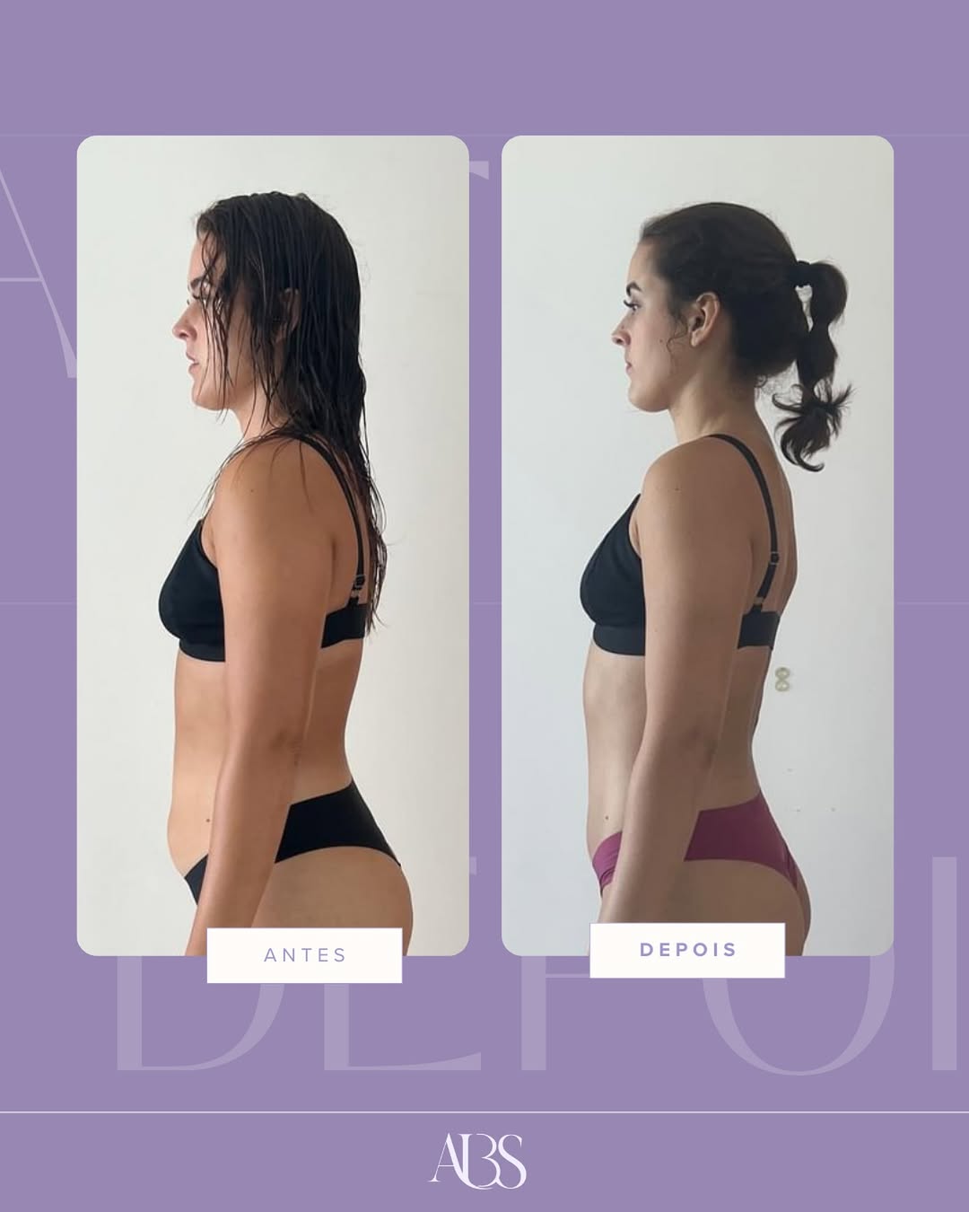 Resultado antes e depois, paciente 1