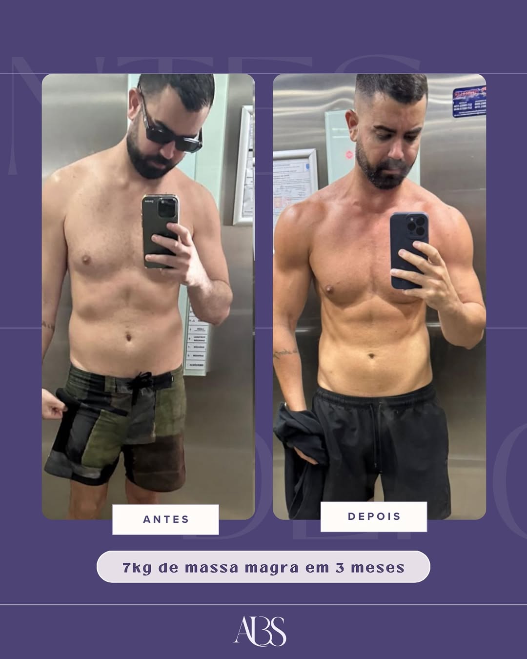 Resultado antes e depois, 7kg de massa magra em 3 meses