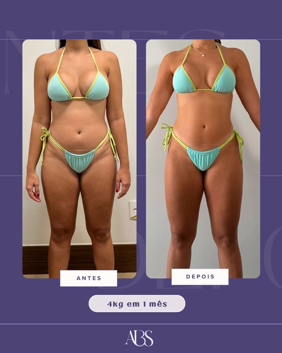 Resultado antes e depois, 4kg em 1 mês